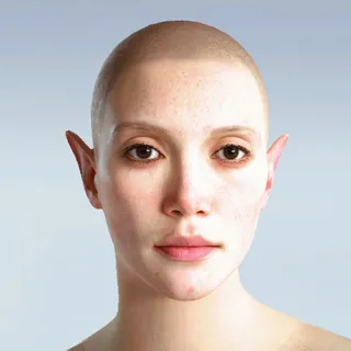 FAE