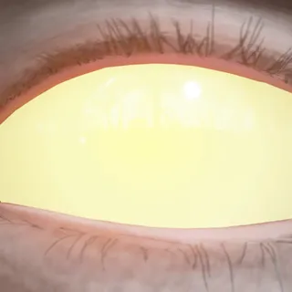 VOIDFLARED EYES