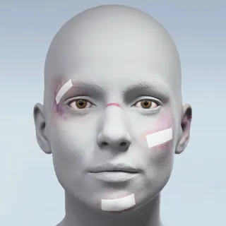 PRETTY BRUISED