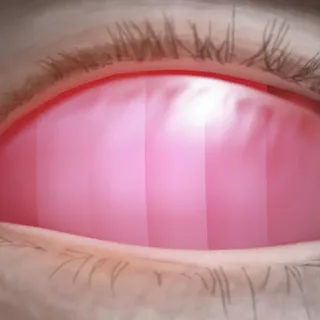 SCORCHED OPTICS