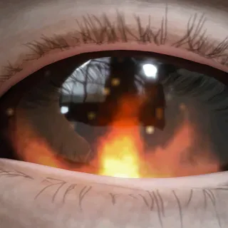SCORCH LENSES