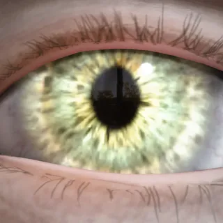 MOSS SIGHT